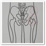 엉덩이 근육 뻐근함 원인과 치료방법